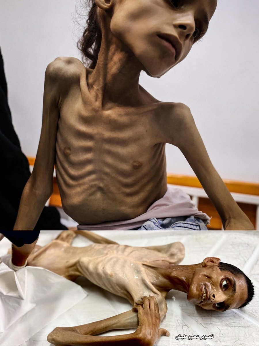 Allah zalim Yahudi kavmini helak ettsin 🤲🇵🇸🇹🇷🇵🇸🇹🇷🇵🇸☝️