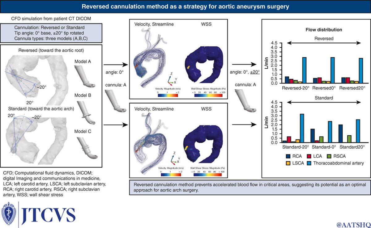 Free until 8/30: Reverse cannulation method as a strategy for aortic aneurysm surgery: A computational fluid dynamics study on minimizing neurological risks. Read what the simulations indicate in #JTCVS: doi.org/10.1016/j.jtcv…