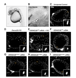 The Hospital for Sick Children (SickKids) (@sickkidsnews) on Twitter photo 🧠 New discovery: #SKResearch in <a href="/Brain1878/">Brain</a> identifies a brain condition with #psychosis & #catatonia linked to the DENND2B gene. Using zebrafish & computational tools, researchers showed these changes disrupt brain cell function.
🔗bit.ly/40KBCI5
#PrecisionChildHealth 🧠 New discovery: #SKResearch in <a href="/Brain1878/">Brain</a> identifies a brain condition with #psychosis & #catatonia linked to the DENND2B gene. Using zebrafish & computational tools, researchers showed these changes disrupt brain cell function.
🔗bit.ly/40KBCI5
#PrecisionChildHealth