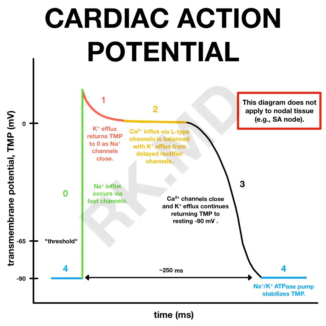 RitikaTuliMD's tweet image. #CardioNugget: 
Brugada Syndrome:
Why that &quot;coved&quot; ST elevation in V1–V3?

✅ Normal heart: Epicardium shows a small phase 1 notch (from transient outward K⁺ current, Ito), but Na⁺ current (INa) dominates, so the notch is shallow. No major voltage gradient → normal ECG.

⚡️…
