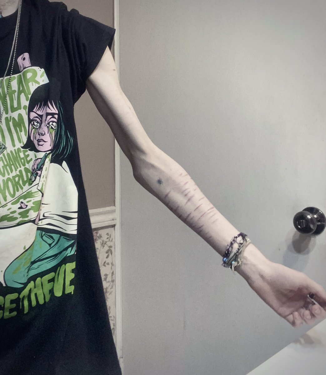 TW weird ahh bc on bathtub ledge

I think I’m getting closer to my pre-hospitalization weight, but I can’t know for sure as I haven’t weighed myself in months cuz my scale got hidden away. Kms