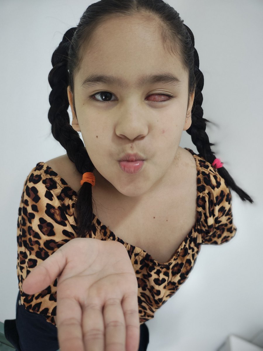 Bueno días gente, 
Estoy a 15 dias de mi viaje y aun nos falta! Necesito juntar para el 20 y poder viajar y thais pueda entrar en quirofano y pueda realizarse su quimiointravitrea,  xfavor gente😭😭🙌 necesito la ayuda de ustedes xfavor de todo corazón 🙌😭