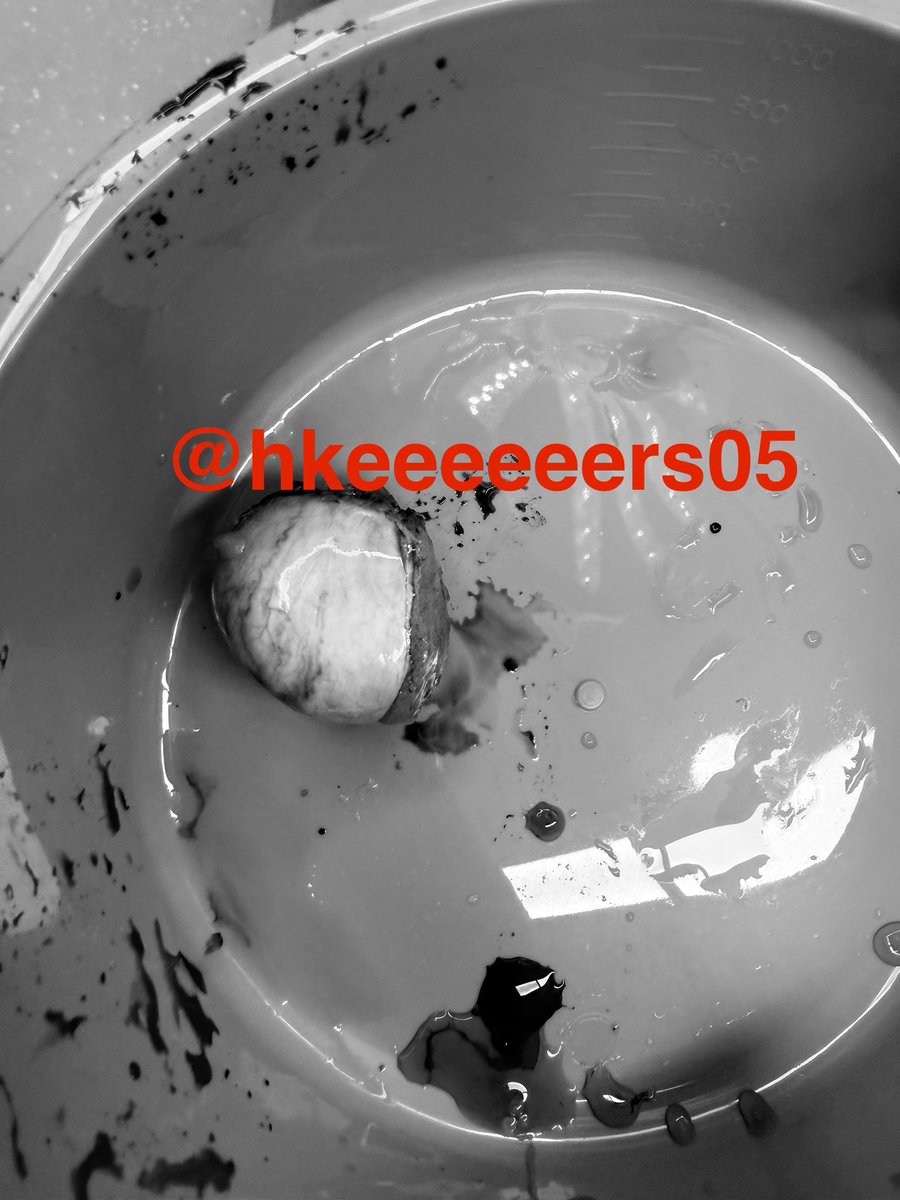 这个蛋是我切过大小能进前三的，不过不是什么好事，怀疑是肿瘤导致的增生
#阉割 #mtf #睾丸切除 #去势 #变性 #虐阳