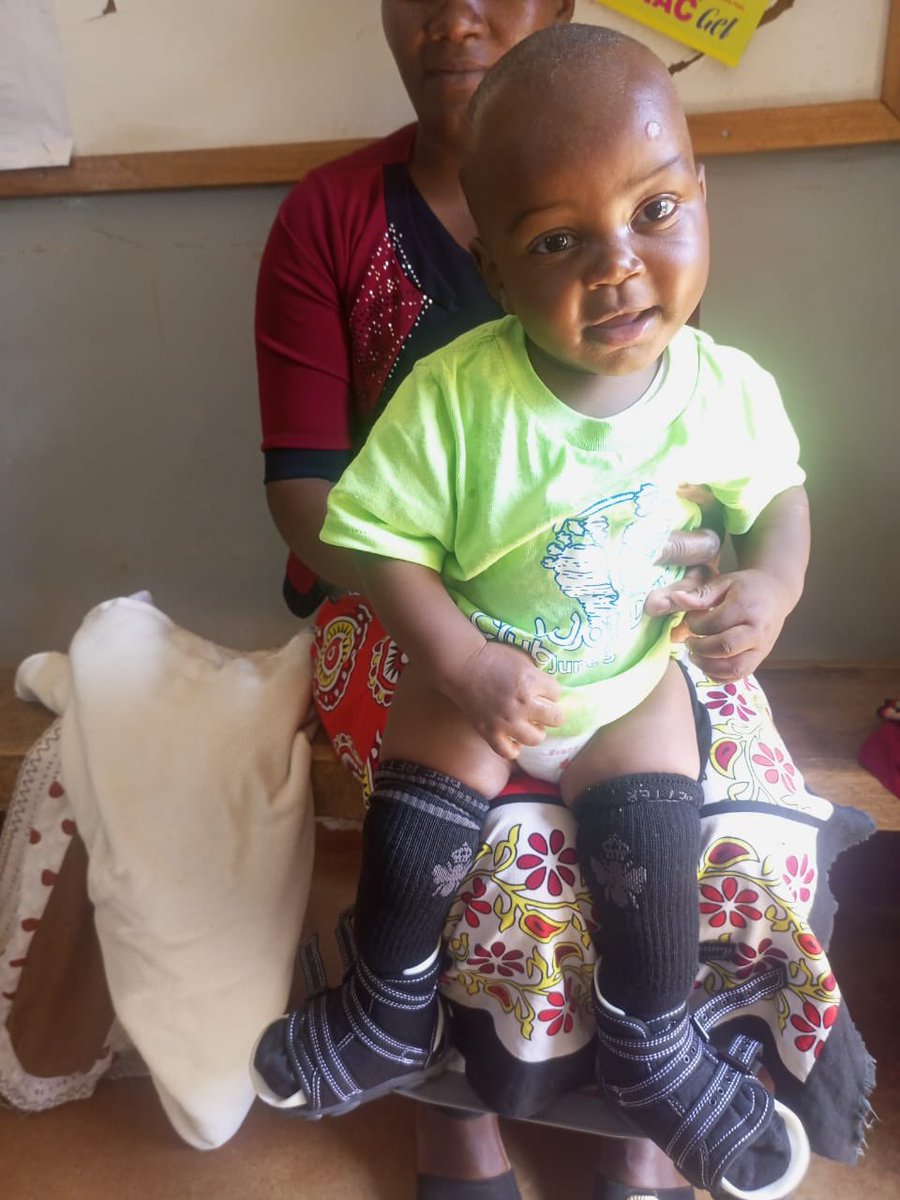 <a href="/Pranai_B/">Pranai Buddhdev</a> <a href="/MSEHospitals/">Mid and South Essex NHS Foundation Trust</a> <a href="/GlobalClubfoot/">Global Clubfoot</a> <a href="/clubfootindia/">CURE India</a> <a href="/Clubfoot_News/">Clubfoot News</a> <a href="/clubfootcanada/">Canadian Clubfoot Support Society</a> <a href="/STEPS_Charity/">Steps Charity Worldwide</a> <a href="/SmallStepsDocs/">Small Steps Project</a> <a href="/STEPS_SA/">STEPS Clubfoot Care</a> <a href="/HelenGille/">Helen Gille</a> <a href="/MSEPatientExp/">Mid and South Essex Hospitals Patient Experience</a> <a href="/HClubfoot/">Head2Toe Charity</a> 😁💚