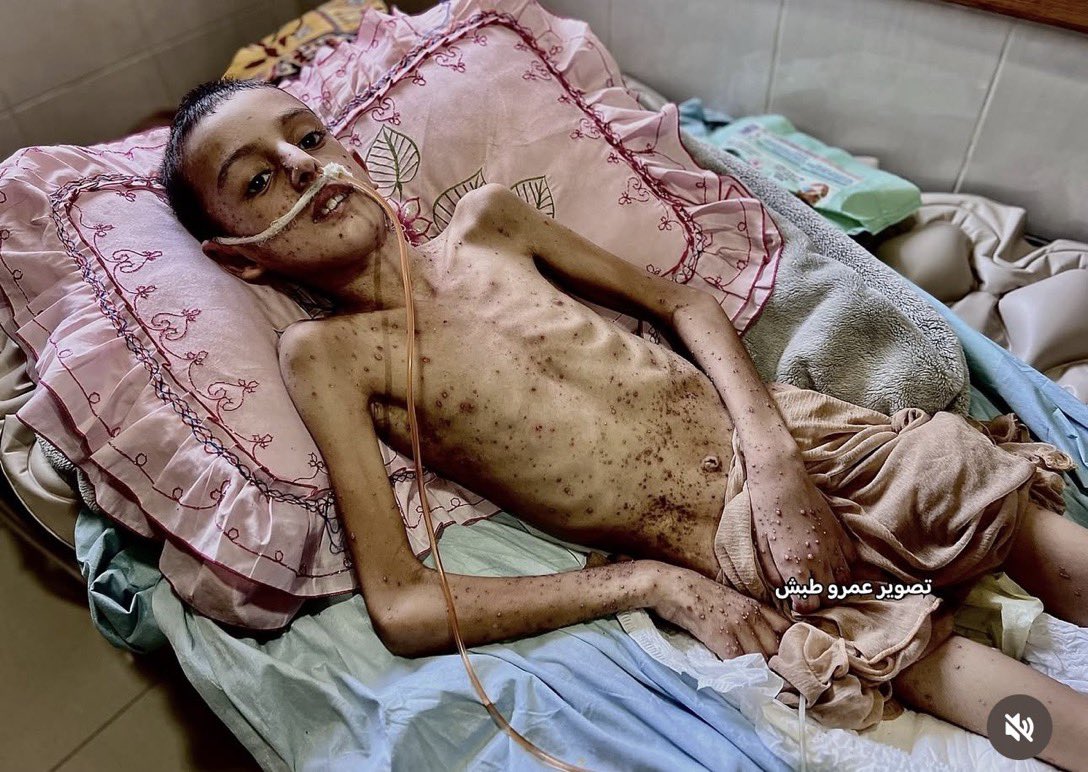 منشور: غزة بين ألم الحصار ومرارة الخذلان

"في كل ليلة، لا تغفو غزة إلا على وجع، ولا تستيقظ إلا على صوت القصف وأنين الجوع. أطفالها يحلمون برغيف خبز، ونساؤها يلملمن بقايا حياة من تحت ركام المنازل. ألمٌ لا يوصف تحت حصار يطبق على الأنفاس من كل جانب.

لكن الألم الأشد، هو الشعور