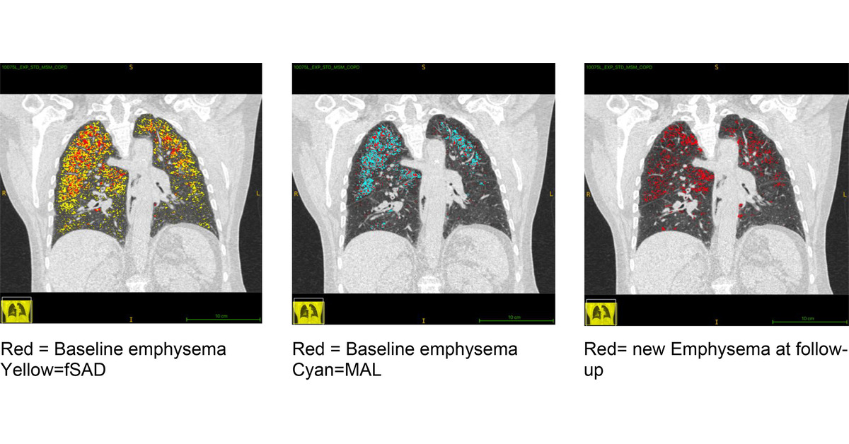 ATS Blue Journal tweet media