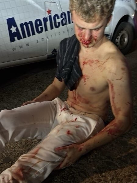 Libs of TikTok (@libsoftiktok) on Twitter photo WOW. The <a href="/DOGE/">Department of Government Efficiency</a> employee who was brutally beaten in DC for defending a woman has been identified as none other than "BIG BALLS"
Big Balls is a HERO! WOW. The <a href="/DOGE/">Department of Government Efficiency</a> employee who was brutally beaten in DC for defending a woman has been identified as none other than "BIG BALLS"
Big Balls is a HERO!