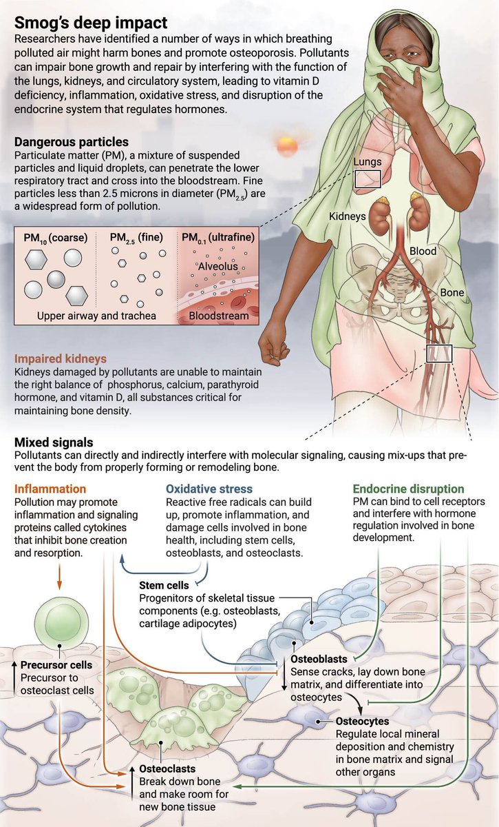 Breathing polluted air increases the risk of #osteoporosis, growing evidence shows.

Learn more: scim.ag/3ZVMvoS #ScienceMagArchives