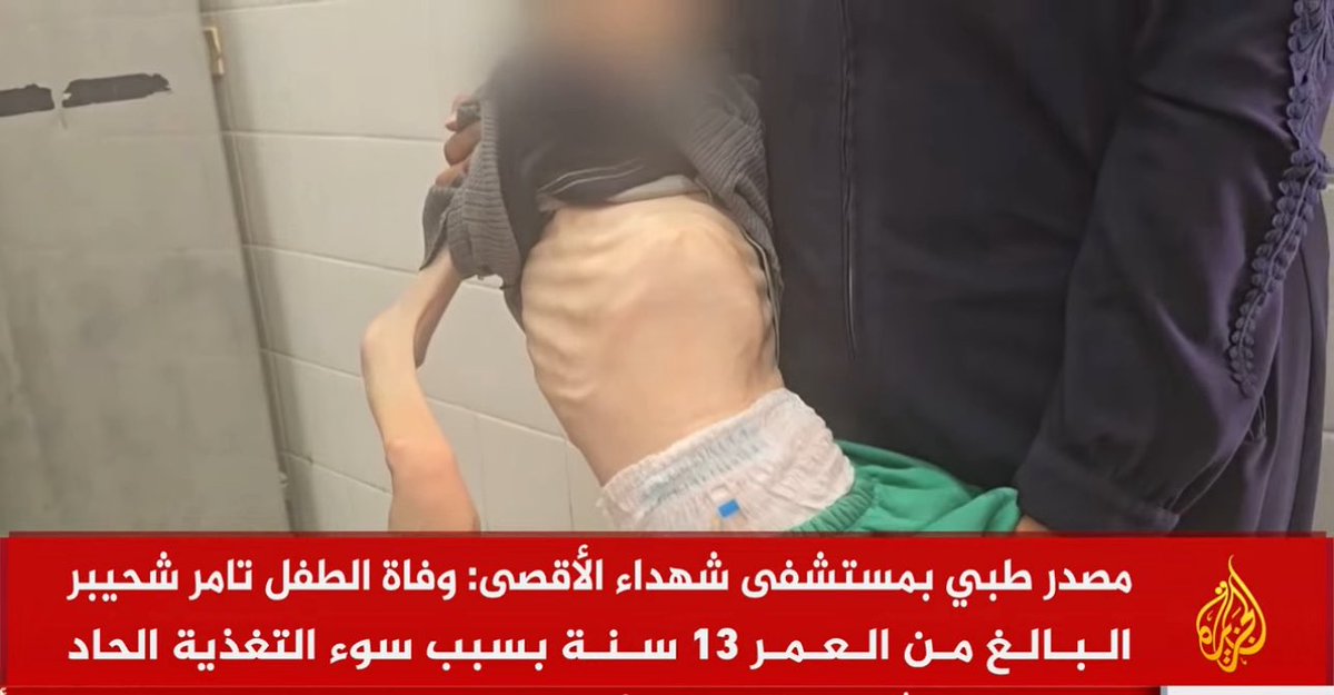 تامر، 13 سنة، جوع.