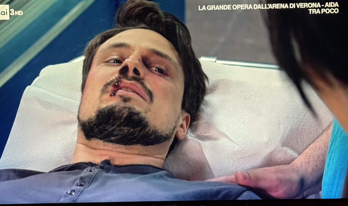 "Anni di studi mi portano a concludere che non hai una bella cera, Gianluca".... 
(Dott.ssa Graziani Rossella).
#upas