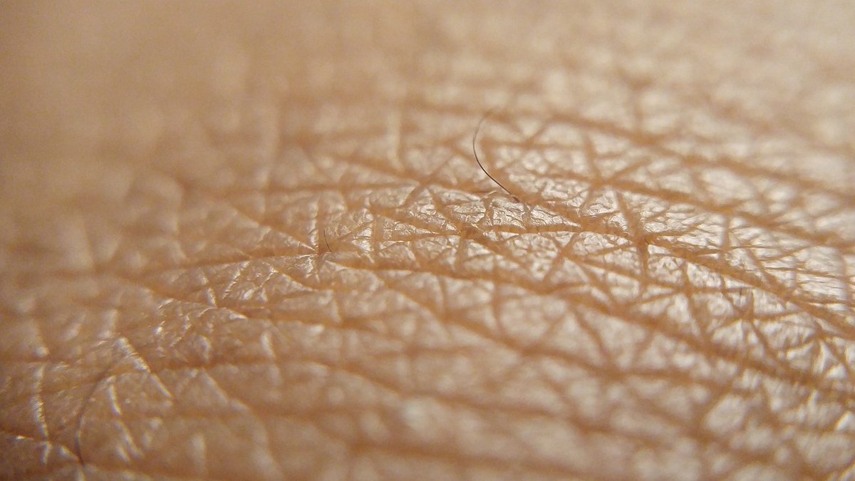 Dermal Cell News (@dermalcell) on Twitter photo This <a href="/SciReports/">Scientific Reports</a> study led by Dr. Faraz Adil was conducted to study the effect of #heparin as a topical wound dressing to improve healing time at donor site. π©Ή
π Read their findings here: go.nature.com/4frR5mk This <a href="/SciReports/">Scientific Reports</a> study led by Dr. Faraz Adil was conducted to study the effect of #heparin as a topical wound dressing to improve healing time at donor site. π©Ή
π Read their findings here: go.nature.com/4frR5mk