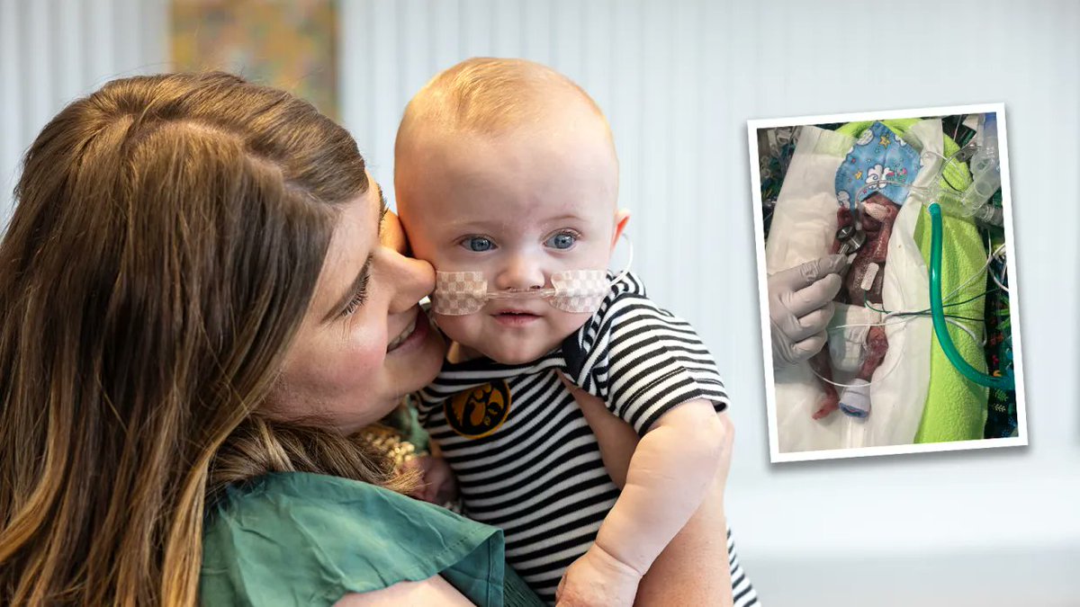 Born at 21 weeks. Now a Guinness World Record holder. 👶✨ 

Nash Keen beat the odds @uichildrens and is now the world's most premature baby.