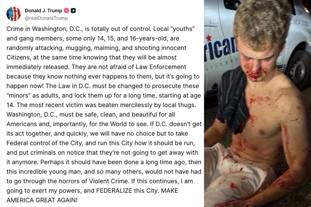 nypost's tweet image. Ex-DOGE staffer nicknamed ‘Big Balls’ left bloodied after savage DC carjacking attempt by 10 juveniles trib.al/8WUo1kR