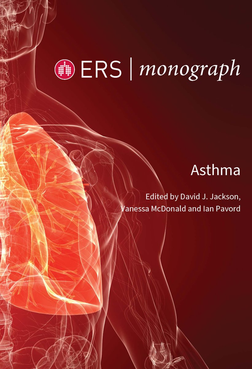 ERS publications (@erspublications) on Twitter photo Childhood asthma is complex. Diagnosis is fundamental to asthma management, and objective measures to demonstrate reversible airflow obstruction and/or airway inflammation are essential to confirm a diagnosis and identify therapeutic targets. <a href="/HMakrinioti/">Heidi Makrinioti</a> bit.ly/ERSM108 Childhood asthma is complex. Diagnosis is fundamental to asthma management, and objective measures to demonstrate reversible airflow obstruction and/or airway inflammation are essential to confirm a diagnosis and identify therapeutic targets. <a href="/HMakrinioti/">Heidi Makrinioti</a> bit.ly/ERSM108