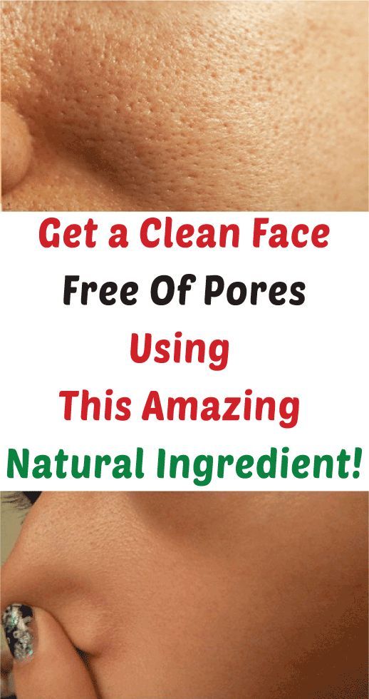 Healthy_Mgz's tweet image. ✨ Want smaller pores—naturally? Just one ingredient to the rescue!

👇 Read this thread to learn how—without expensive products.
🔗healthmgz.com/2022/09/how-to…
 
#PoreMinimizer #NaturalSkincare #DIYSkinCare #SmoothSkin #CleanBeauty #SkinCareTips #HomeRemedy #GlowNaturally