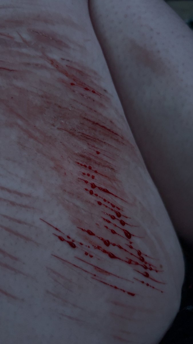 st0ner420x's tweet photo. Sesh on call w @weirdcuriousff_ @ech0edstarzz #shtwt #SELFHARM #SELFHARMWARNING https://t.co/DFQNc2aQkI