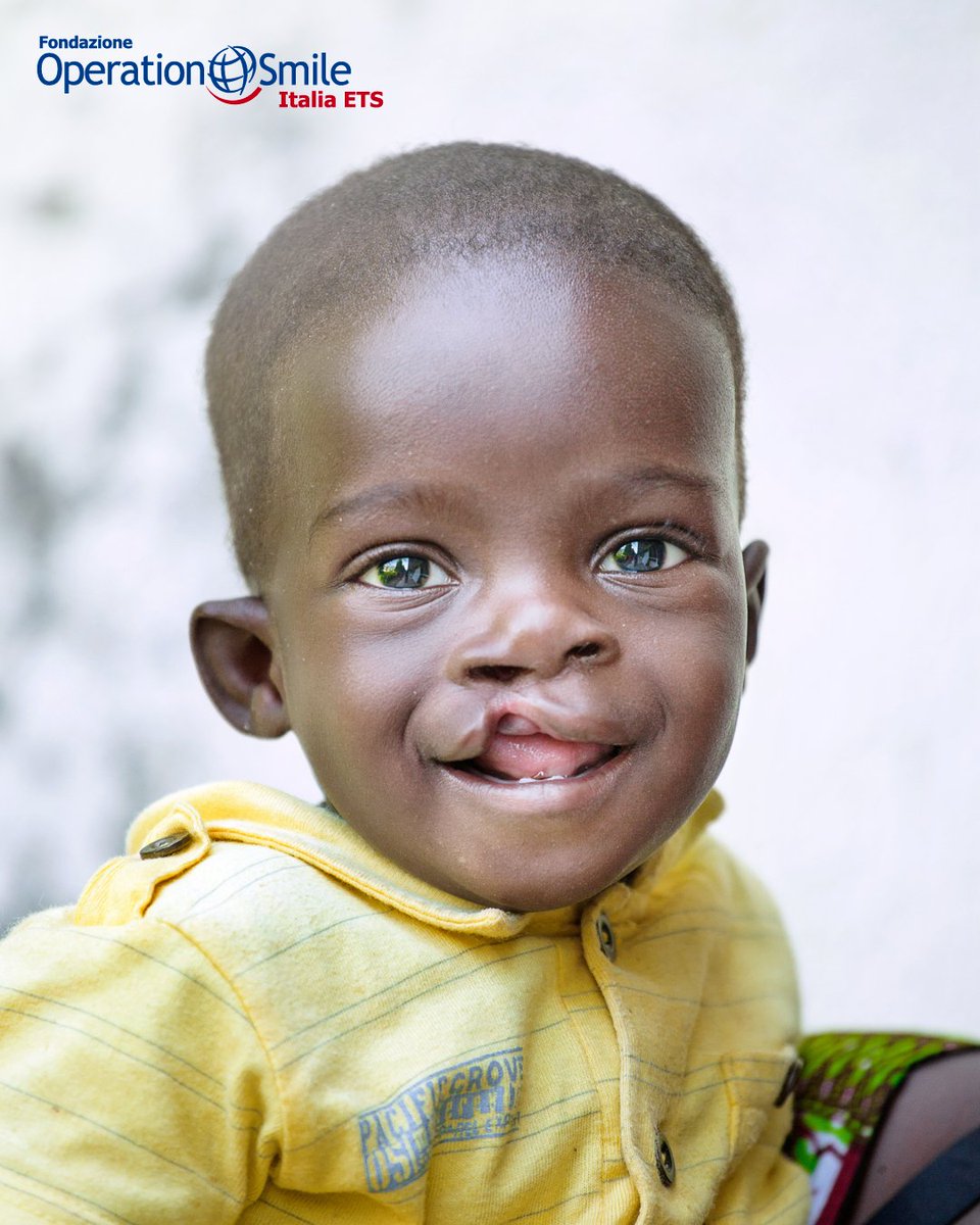 Durante uno dei nostri programmi chirurgici in #Ghana, nel 2017, Jesus è stato sottoposto a un intervento chirurgico che gli ha cambiato la vita.

🤲🏼Dona “nuovi sorrisi” a bambini come lui: operationsmile.it/dona-ora/

#OperationSmile #OperationSmileItalia #UnSorrisoCambiaTutto