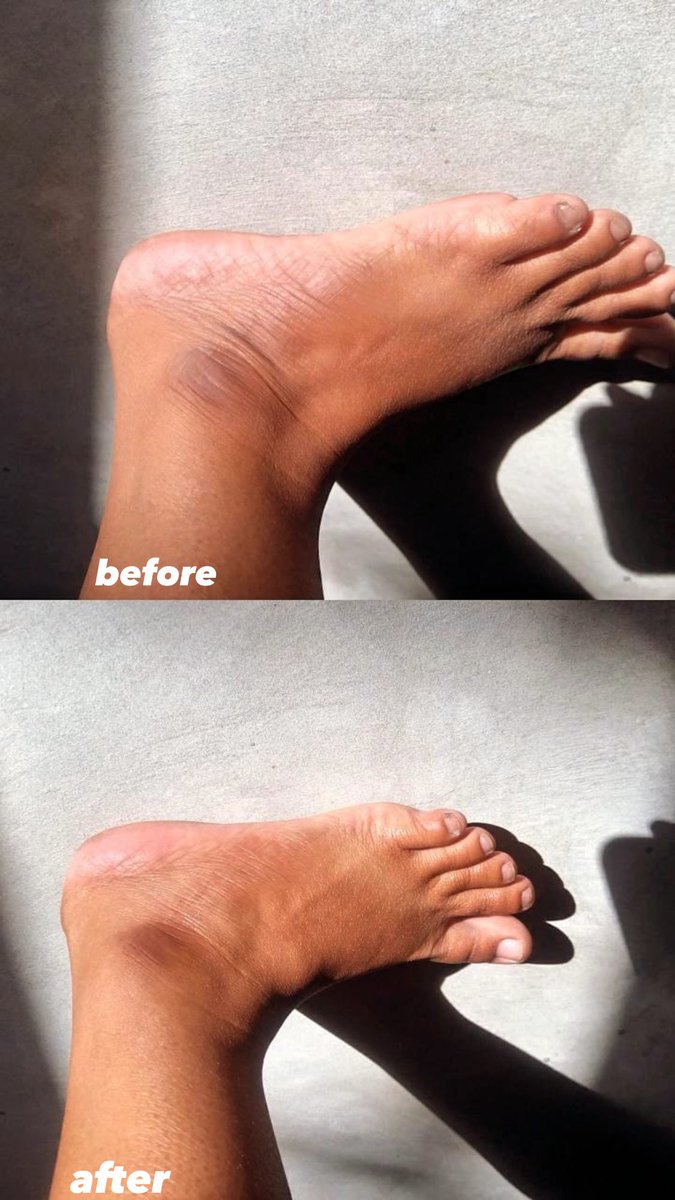 Body lotion? Ribet &amp; lengket.
Body oil? Kadang greasy.
Tapi AlmondDry dari Buttered beda cerita 🤌🏻
Teksturnya ringan, cepet nyerap, wangi almond-nya tuh... soft &amp; calming banget. Kulit glowing tapi gak kayak gorengan 🧴✨
🛒 s.shopee.co.id/5pxlci5aUM