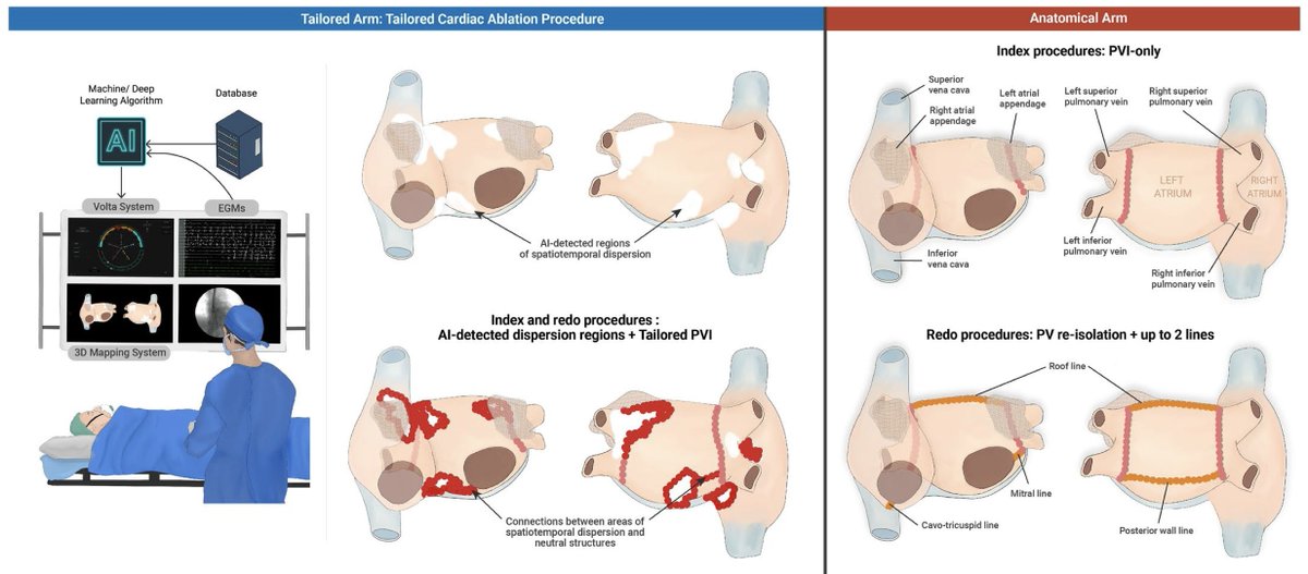 #EHRAtopicweek
How we use #AI in EP now?

TAILORED- AF RCT on individualized #AI-guided ablation of #AF
🔹 374 pts randomized: 188 tailored vs 186 anatomical
🔹 AI-guided ablation + PVI &gt; PVI alone for 1-year freedom from AF in persistent/long-standing AF

🔗