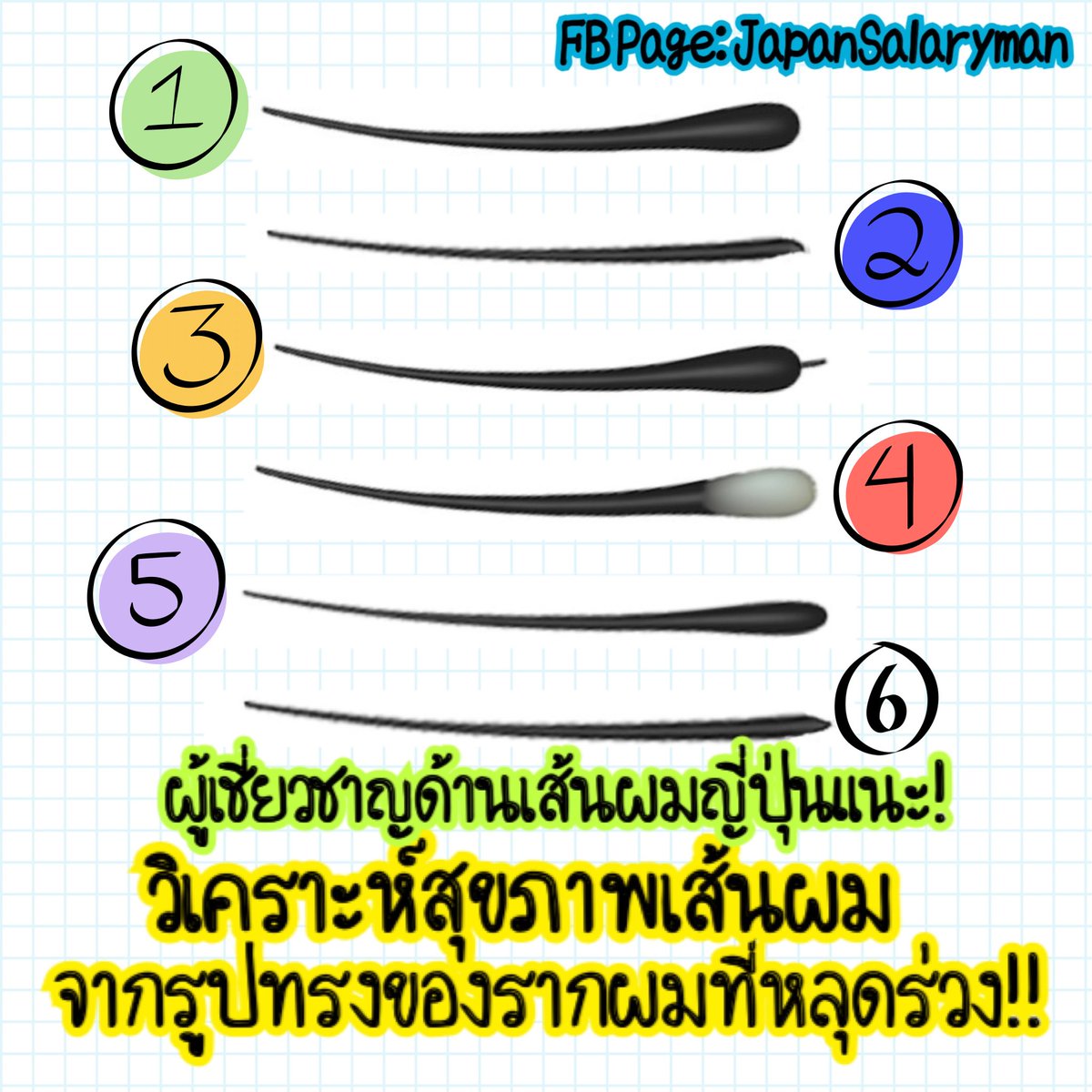 JapanSalaryboom's tweet photo. แต่ก่อนเคยคิดว่า “รากผมไม่สำคัญ”
แต่พอได้อ่านโพสต์นักทำผมระดับโลกจากญี่ปุ่น (ที่เคยดูแลผมนางแบบปารีสแฟชั่นวีค) ถึงได้รู้ว่า… “รากผม” คือตัววัดว่าเส้นผมแข็งแรงหรืออนาคตอาจร่วงหมดหัว
.
แค่ดูโคนผมที่หลุดออกมา ก็สามารถวิเคราะห์สุขภาพผมทั้งหัวได้ เขียนเรื่องนี้เต็มๆ ในเธรดนี้นะ👇 https://t.co/0M3a1aZNqm