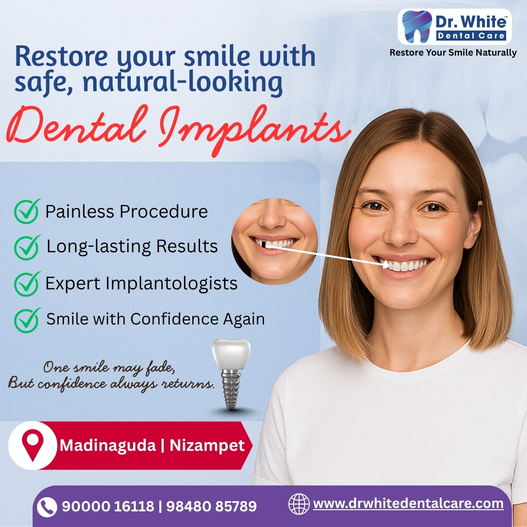 drwhitedc's tweet image. 🦷 Missing teeth? 
Smile again with safe, natural-looking Dental Implants at Dr. White Dental Care!

✅ Painless
✅ Long-lasting
✅ Expert Implantologists
📍Madinaguda | Nizampet
🌐 drwhitedentalcare.com

#DentalImplants #ImplantExperts #ToothReplacement #DrWhiteDentalCare