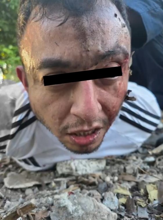 tabascoaldiamx's tweet photo. 🚨 Capturan a Arturo Guzmán, alias el Vampiro, tras un enfrentamiento en Villahermosa. Fue herido y trasladado al hospital bajo fuerte custodia. @SSP_Tabasco @FGE_Tabasco #Villahermosa #Tabasco #Seguridad #ElVampiro #Captura #GrupoTiburón #FIRT #Justicia https://t.co/ysPlnLcrYD