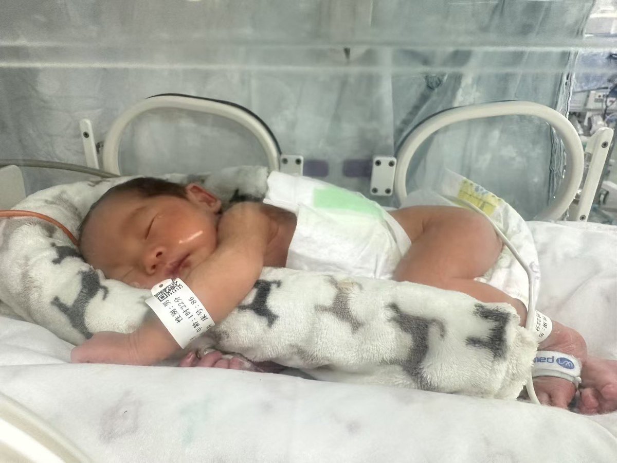 [喜讯]
#男宝 小勇士在护士姐姐的巧手下，裹着暖暖的小抱枕，像在妈妈肚子里一样睡得香甜又踏实～🌙💤 几天后就能回家啦，期待开启“奶爸奶妈”副本，感恩所有朋友对我们信任与支持，使命已完成，愿幸福安康！❤️ 咨询微信：a18025307951
#HIV生子 #三代代孕 #包成功代孕 #洗精代孕 #三代包成功 #广州代孕