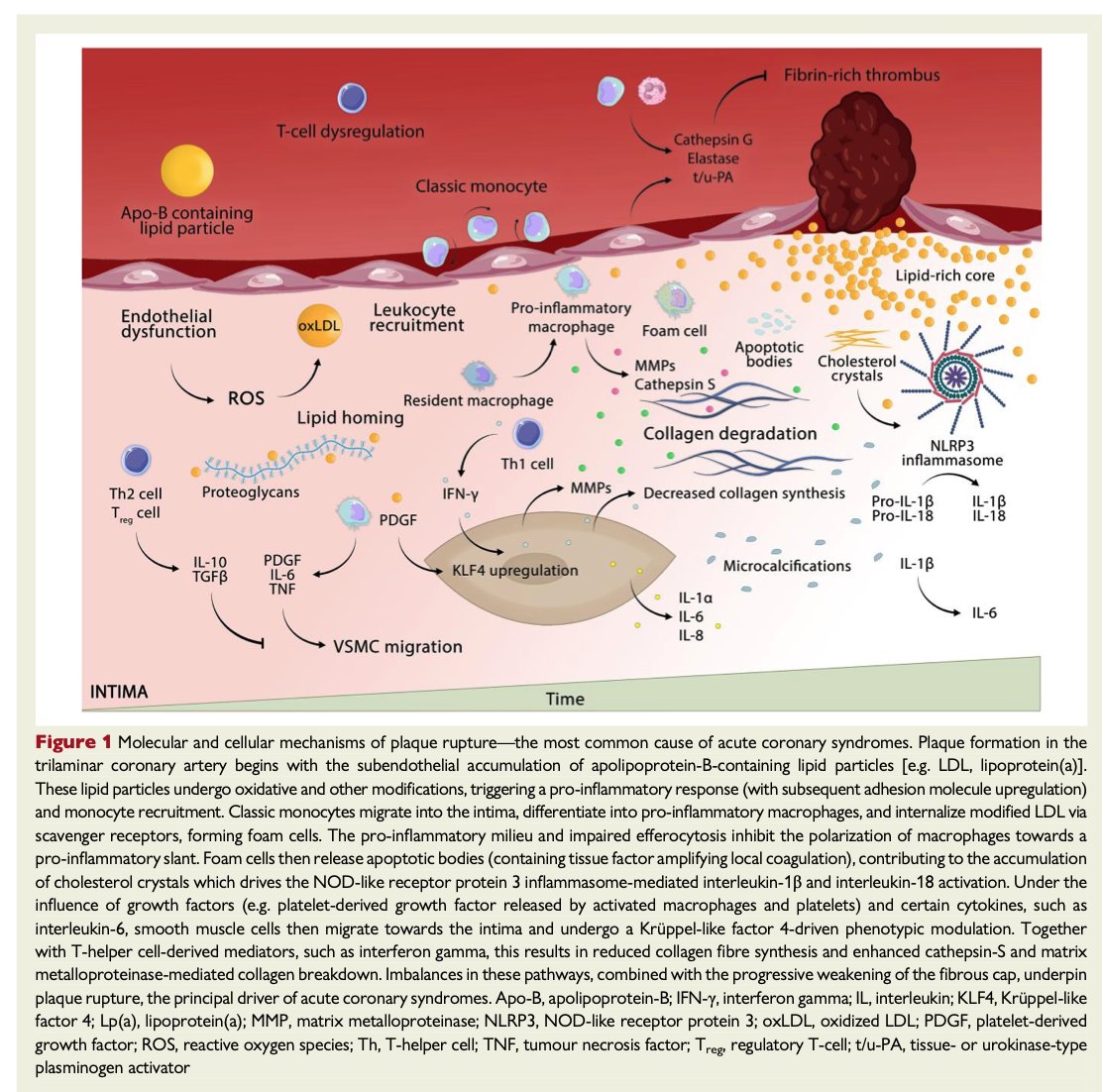 🥸2️⃣ Most ACS events are caused by coronary plaque rupture or plaque erosion, but other mechanisms include calcific nodules, embolism, spontaneous coronary artery dissection (SCAD), coronary spasm, and microvascular dysfunction.