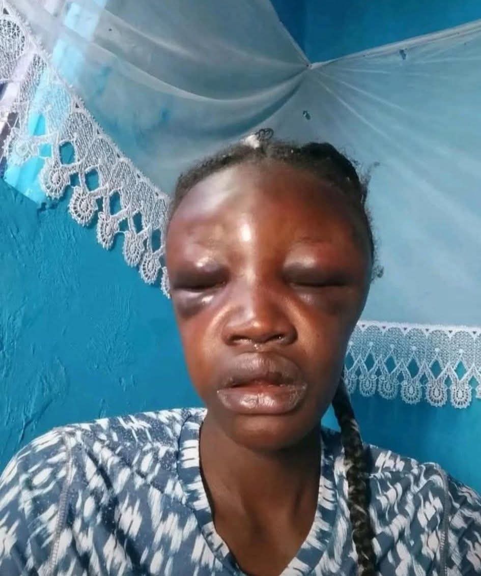 This thing called Mareej will send many to Sayuni prematurely. It was 2:03 AM, Ongwaro was quiet, except for a lone mosquito doing a solo concert in Mama Achieng’s ear and the distant vruuum of a drunk boda boda rider chasing invisible clients. Then came a furious knock at the