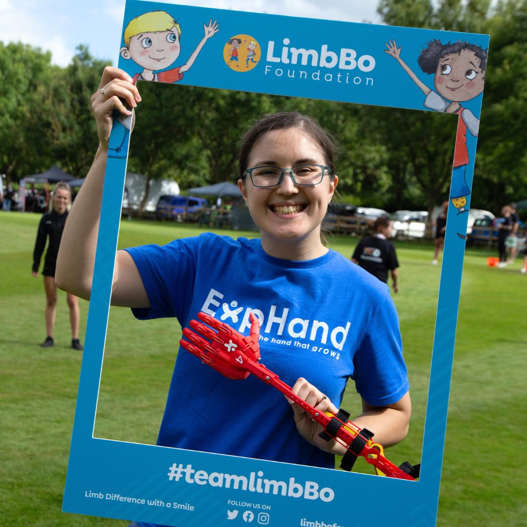 Look out for us in blue tomorrow at the annual @limbbofoundation Adventure Day🎉

We'll be there to answer any questions about the ExpHand💙✨ 

Come say hello!

#LimbBoAdventureDay2025 #limbdifference #disabilityawareness #prosthetics #pediatricprosthetics #kidsprosthesis