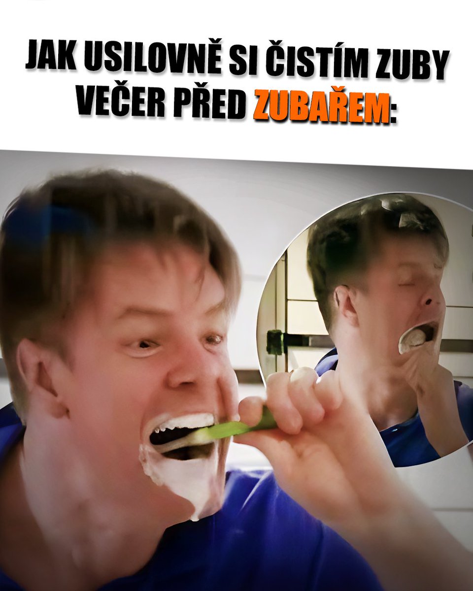 Vedator5's tweet image. 💉 Již poněkolikaté vzniká očkování na zubní kazy – proti bakterii Streptococcus mutans!

Bude ale úspěšnější než dřívější snahy? 🤔

Víc hír ► vedator.org/kazockovani (link na kanál v bio) 📺

#zuby #pohroma #huby #veda #science