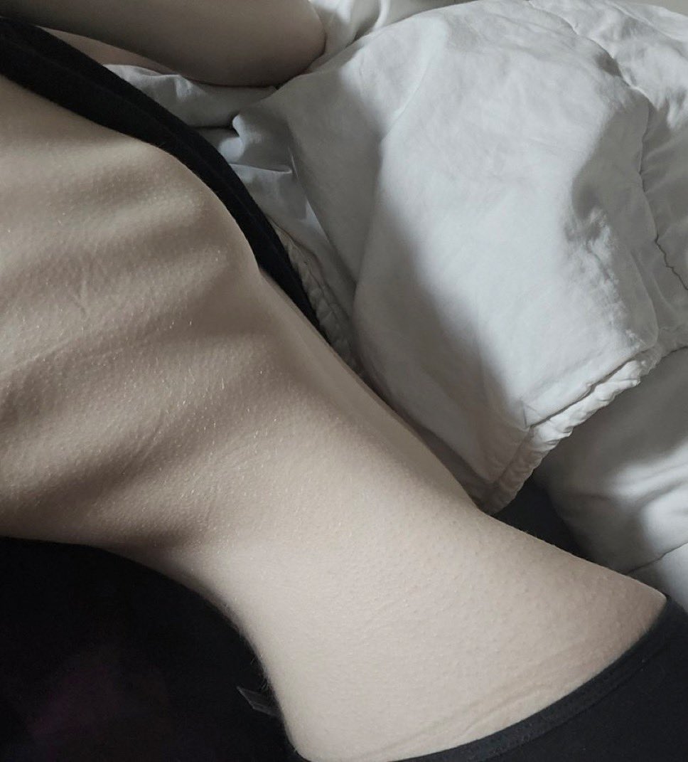 fainthunger's tweet image. ﹒　𓊆†𓊇　#edtwt intro　｡  ﹗
➴　.     thinspo acc, i try to post daily^^
﹕ ౨ৎ   ┄  ugw: 45kg, non-edtwt dni
➴　.     i take submissions, dm me
﹕౨ৎ   ┄  likes &amp;amp; rts appreciated!

#edtwt #anatwt #miatwt #ednos #ricecaketwt #thinspo #bonespo #skinnyspo