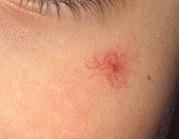 What is the clinical sign?
What are the causes?

#MEDHM #MedX <a href="/IhabFathiSulima/">Dr Ihab Suliman</a>