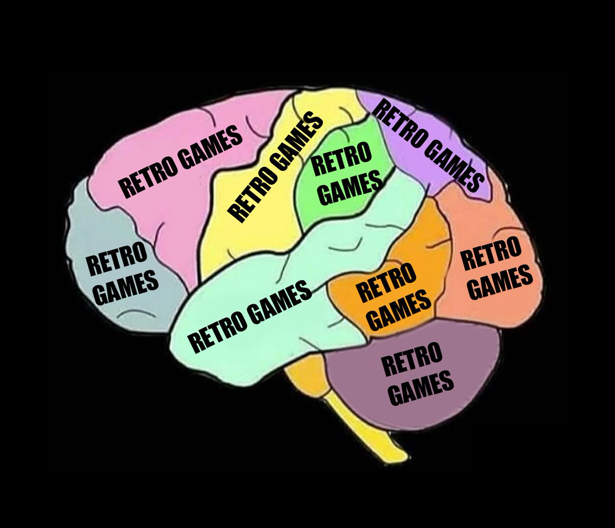 Accurate scan of an Antstream staff member's brain: