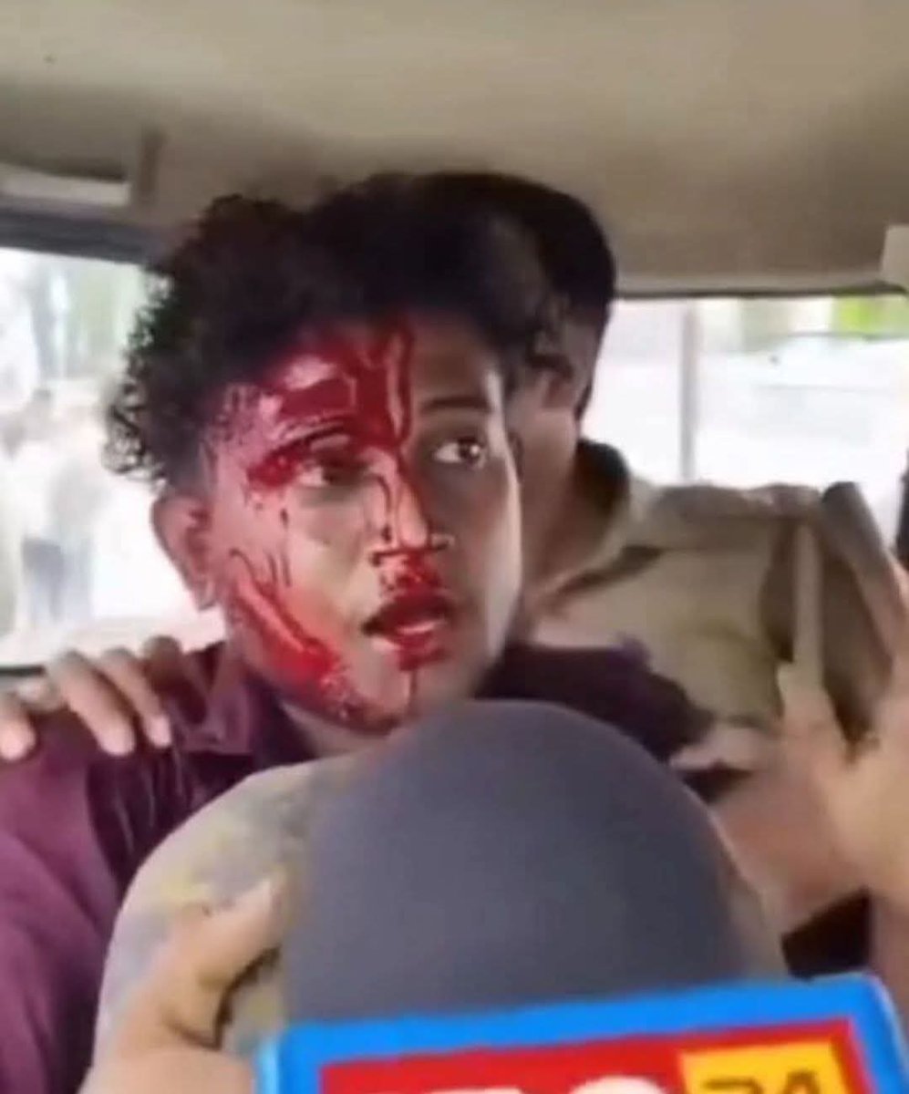 यदि स्वामी प्रसाद नेवला को छूने के लिए इस लड़के रोहित दूबे को गिरफ्तार किया गया है तो रोहित दूबे के ऊपर जानलेवा हमला कर लहूलुहान करने वालों को भी सम्बंधित धाराओं (307 समेत अन्य) मे मुकदमा पंजीकृत कर तत्काल प्रभाव से गिरफ्तार किया जाये..
<a href="/myogiadityanath/">Yogi Adityanath</a> <a href="/brajeshpathakup/">Brajesh Pathak</a> <a href="/aajtak/">AajTak</a>