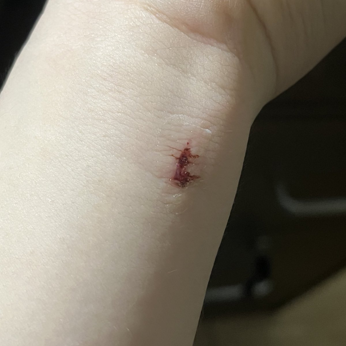 我的手要斷掉了🥹

事情是這樣的
今天家外面的陽台出現了會飛的小強
我寶貝為了要消滅它
就把陽台門打開
站在陽台門
拿著殺蟲劑對著小強噴
然後為了怕小貓咪跑出去
所以我就負責抱著小貓咪
殊不知小貓咪一聽到殺蟲劑的聲音
被嚇到亂抓
然後我的手手就遭殃了