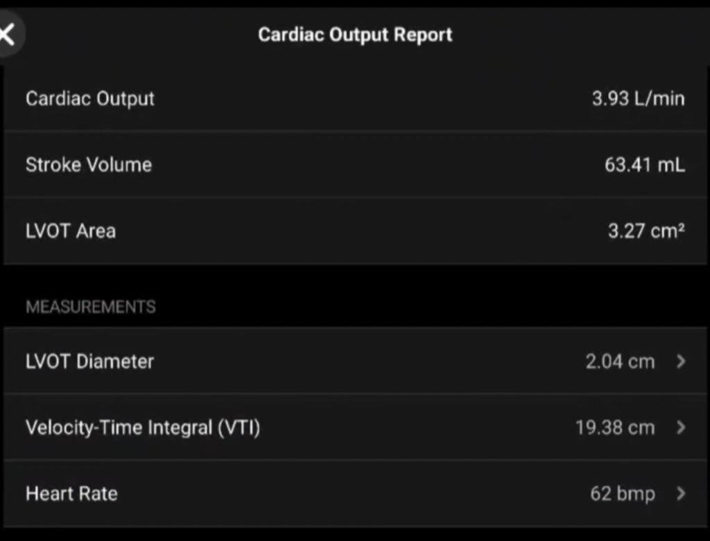 Avel con V chica 🥸 tweet media