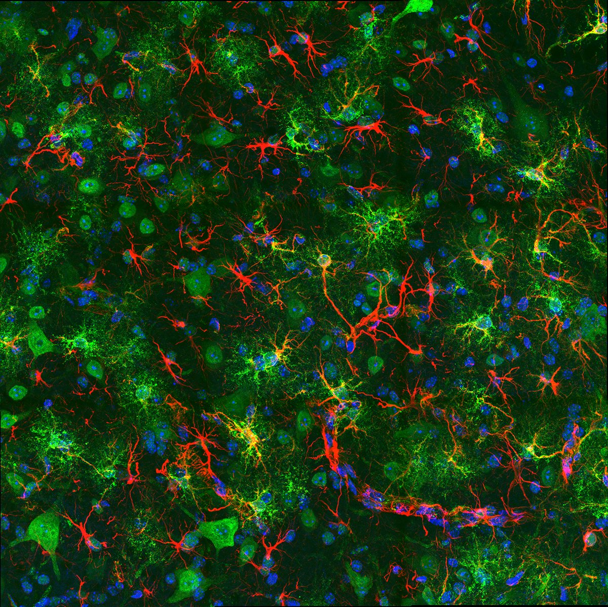 Broad Institute (@broadinstitute) on Twitter photo New findings from <a href="/VamsiMootha/">Vamsi Mootha</a> and @fumitoichinose show low-oxygen air reverses Parkinson’s symptoms in mouse model, suggesting possible new way to treat this neurodegenerative disorder: a pill that mimics low oxygen. broad.io/Parkinsons-Oxy… New findings from <a href="/VamsiMootha/">Vamsi Mootha</a> and @fumitoichinose show low-oxygen air reverses Parkinson’s symptoms in mouse model, suggesting possible new way to treat this neurodegenerative disorder: a pill that mimics low oxygen. broad.io/Parkinsons-Oxy…