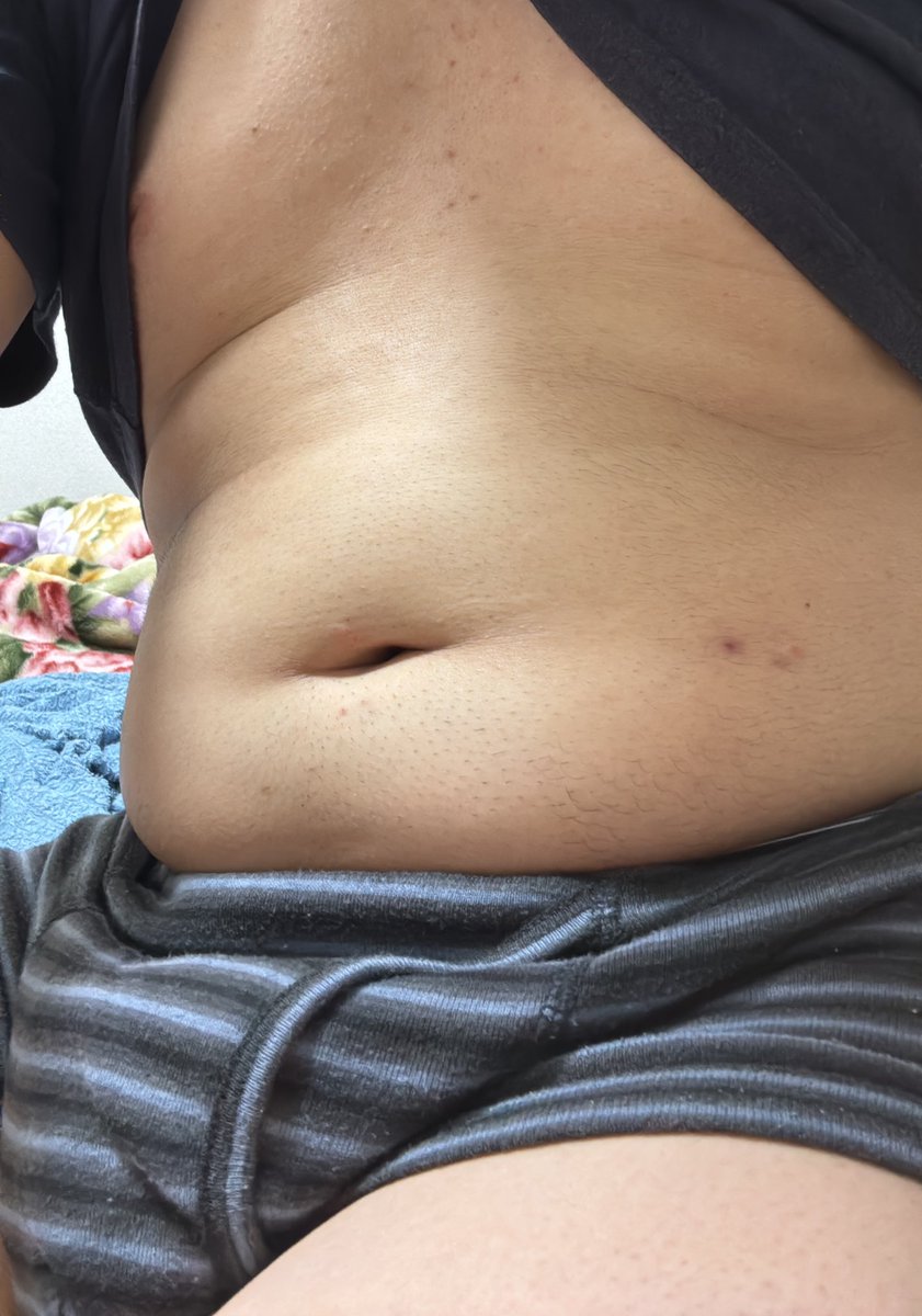 毛剃ったら別人、、ですかね？笑