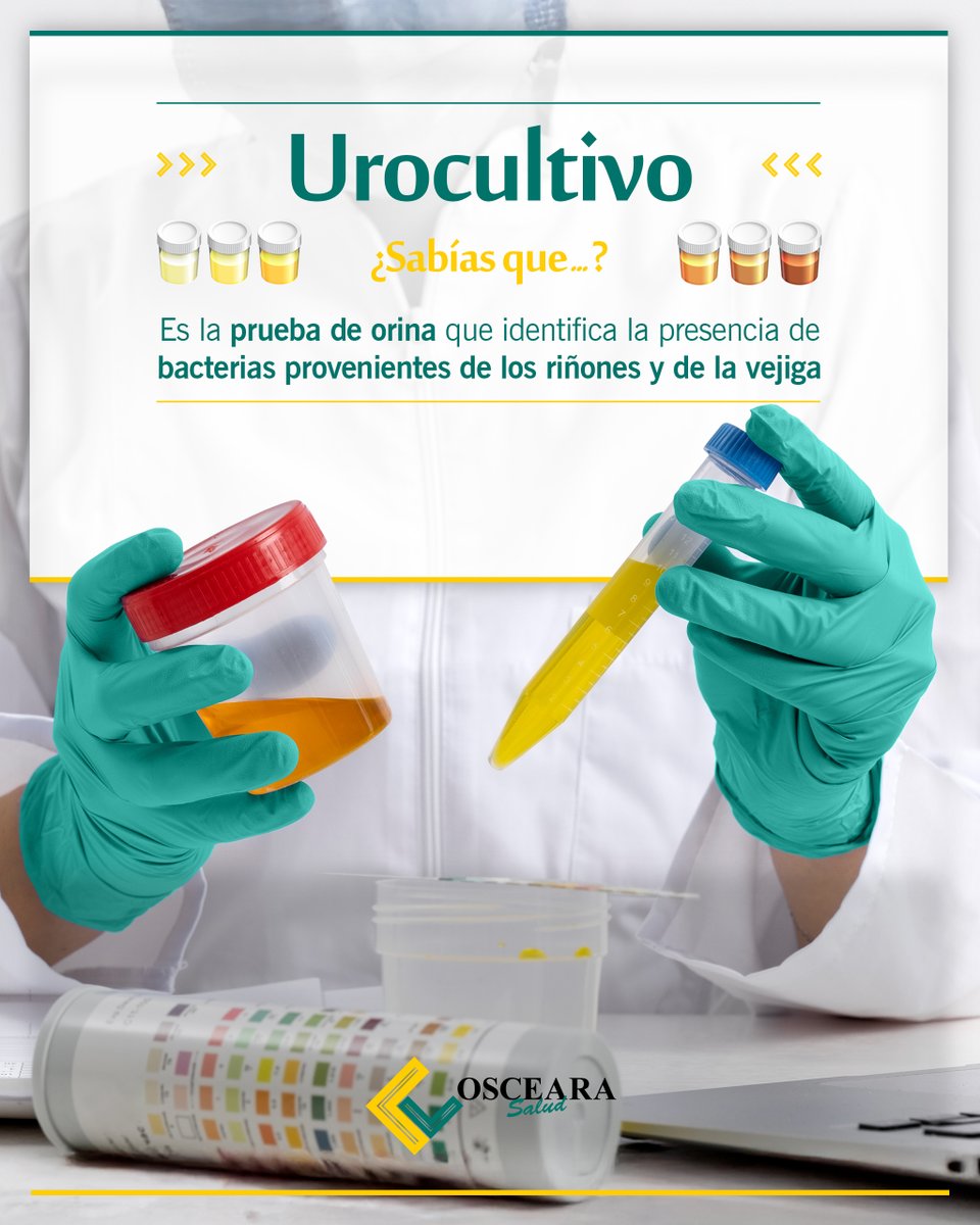 OscearaS's tweet image. 👨🏼‍⚕️La orina refleja el estado de órganos clave como los riñones, el hígado y las vías urinarias. Detectando infecciones, desequilibrios metabólicos, problemas renales o hepáticos y más. 🩺

#Urocultivo #estudiosmédicos #orina
