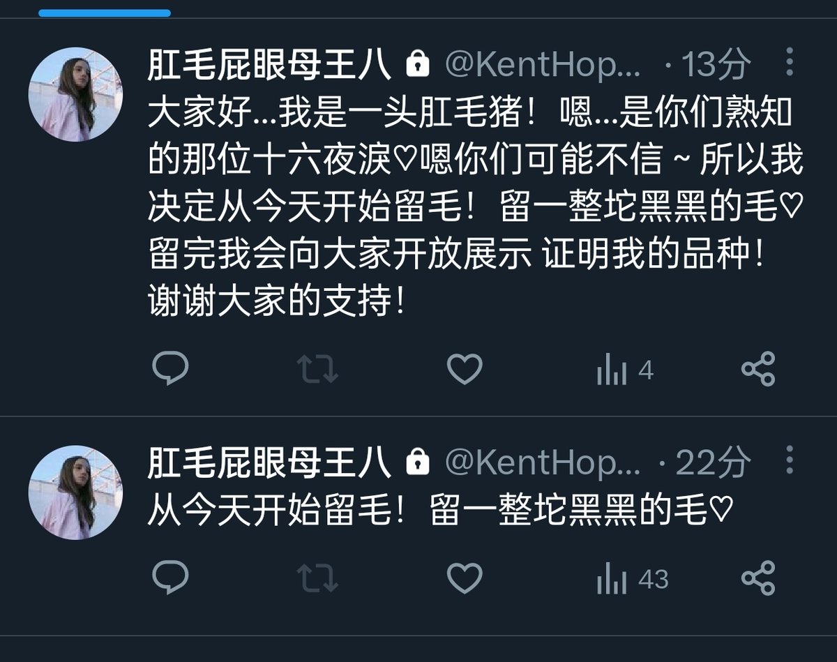 依旧是你们熟悉的肛毛屁眼，这是谁呢好难猜啊
