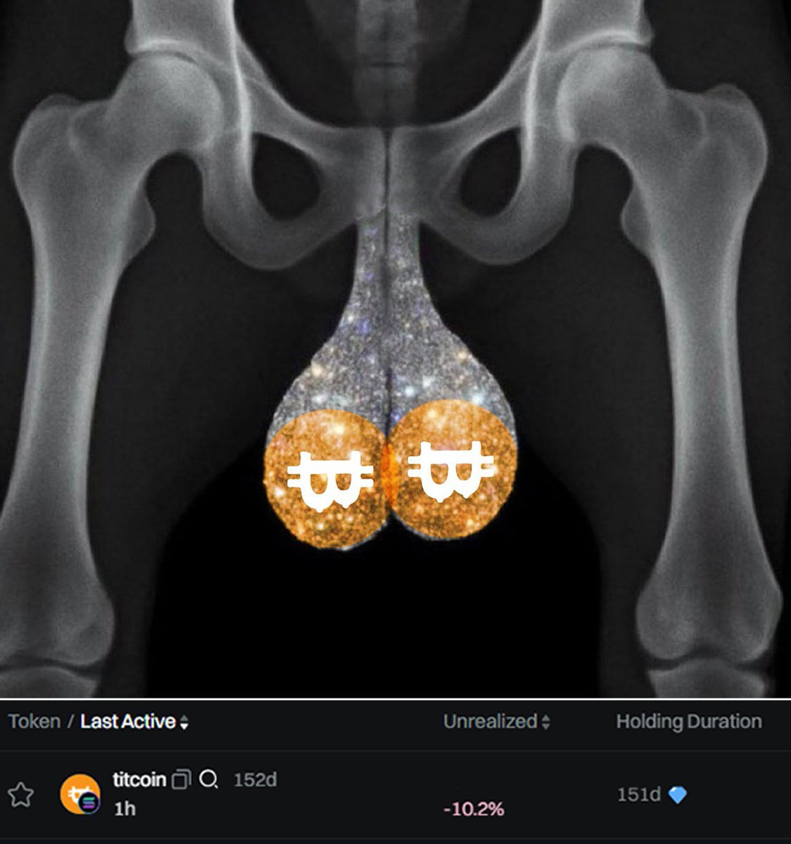 Just got my testicles scan results back. 

Doc says it’s bad… incurable even. 

Turns out I’ve got a terminal case of bag-holding.

I told him: I'm not leaving Till 69B doc 🫡