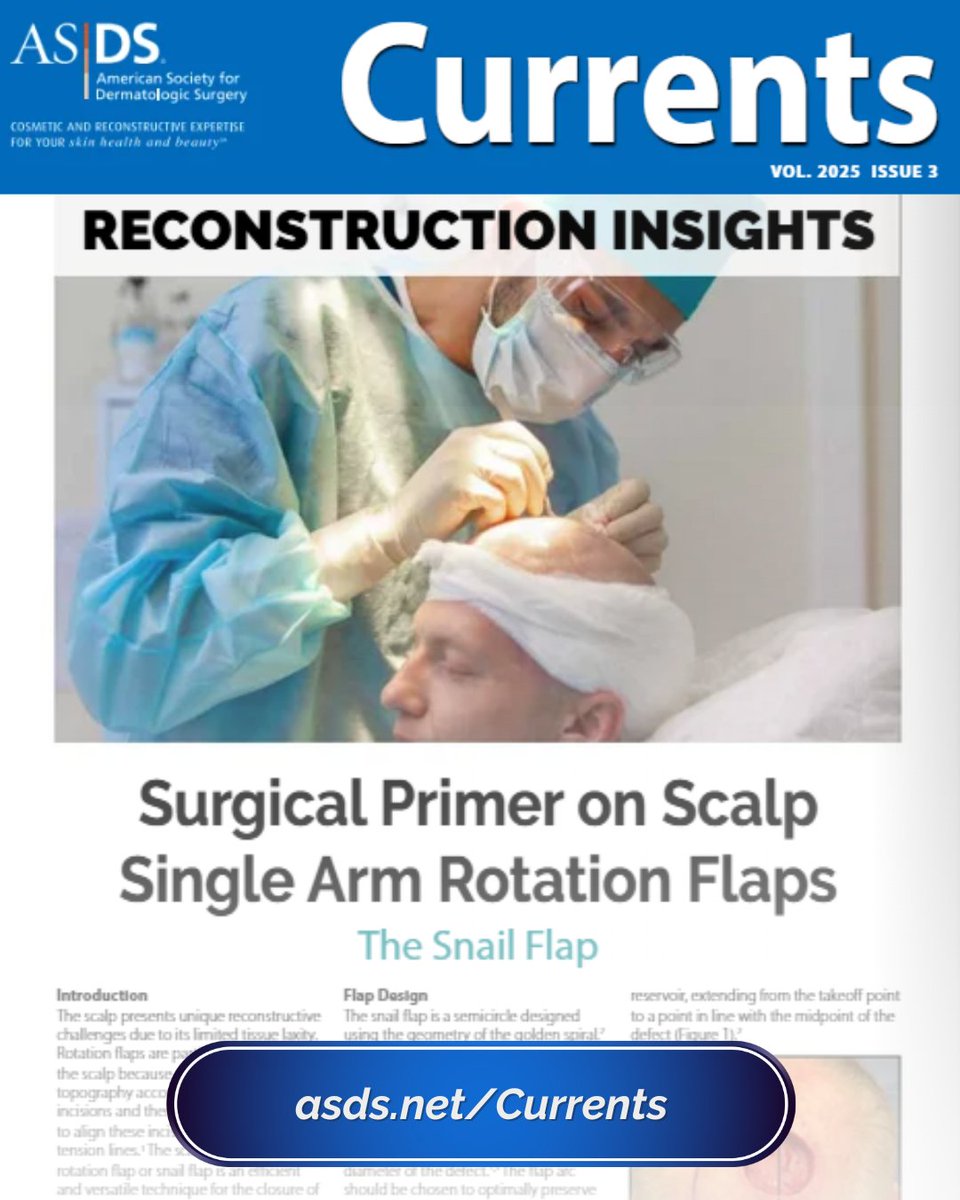 In the latest issue of Currents, Drs. Brandon Burroway and Stacy McMurray detail their expertise on the scalp single arm rotation flap. They walk readers through the flap design with figures to illustrate their technique.

➡️Read the article at asds.net/currents.