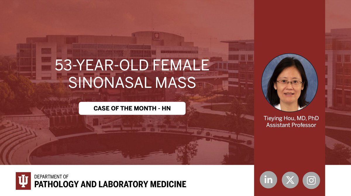🆕 New Case of the Month 🚨 
Check out our second case and follow along each month! 

Contributed by: Tieying Hou, MD, PhD
Assistant Professor and Section Head of Head and Neck Pathology <a href="/TieyingH/">Tieying Hou</a> 

🔗 medicine.iu.edu/pathology/educ…

#pathtwitter #medtwitter #HNpath #COTM #iupathology