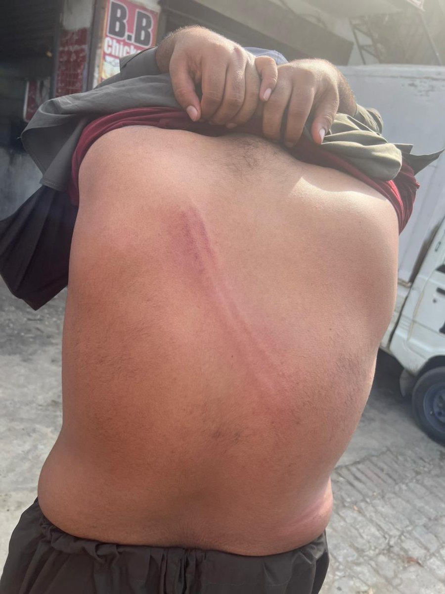 میاں شہزاد فاروق اور یوتھ کے نوجوان ساتھیوں کو عمران خان سے محبت کرنے پر اور احتجاج کرنے پر ریاست نے بے حد تشدد کیا-