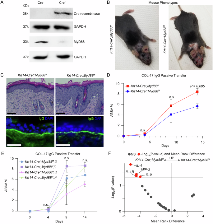 Waggoner Lab (@labwaggoner) on Twitter photo In a preclinical mouse model of bullous pemphigoid, keratinocyte-specific Myd88 knockout significantly decreases disease severity and reduces serum levels of IL-4 and IL-9 <a href="/NatureComms/">Nature Communications</a>
nature.com/articles/s4146β¦ In a preclinical mouse model of bullous pemphigoid, keratinocyte-specific Myd88 knockout significantly decreases disease severity and reduces serum levels of IL-4 and IL-9 <a href="/NatureComms/">Nature Communications</a>
nature.com/articles/s4146β¦