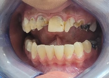 Anti Tradition tweet media