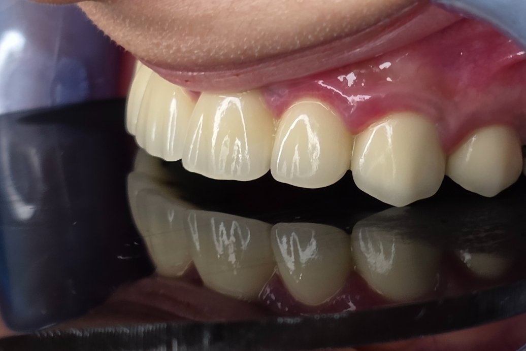 Anti Tradition tweet media