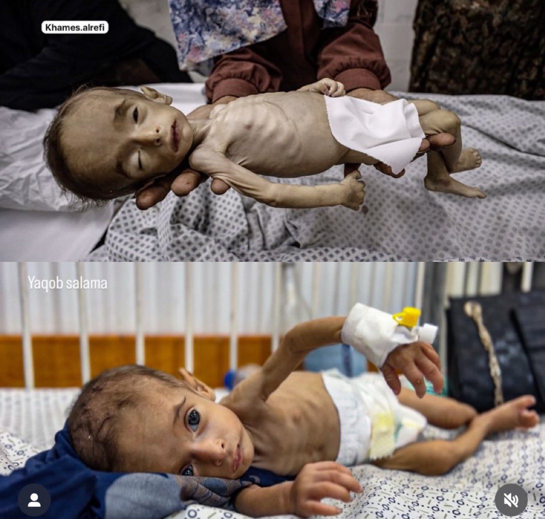 MotazSaleh2001's tweet photo. If you’re scrolling, PLEASE leave a dot.

STARVATION. https://t.co/Y6QouubrzL