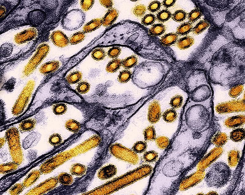 CIDRAP (@cidrap) on Twitter photo Cambodia announces 15th human H5N1 infection of the year
Seven of the 15 cases from Cambodia this year have been fatal, resulting in a case-fatality rate of 46.6%.
cidrap.umn.edu/avian-influenz…
Photo: NIAID/Flickr cc Cambodia announces 15th human H5N1 infection of the year
Seven of the 15 cases from Cambodia this year have been fatal, resulting in a case-fatality rate of 46.6%.
cidrap.umn.edu/avian-influenz…
Photo: NIAID/Flickr cc